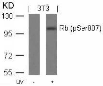 Western Blot: RB1 [p Ser807] Antibody [NB100-82177]